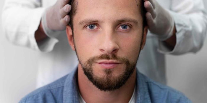 Hair Transplant Cost in 2024: What You Need to Know