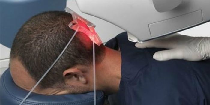 Artas Hair Transplant Technology