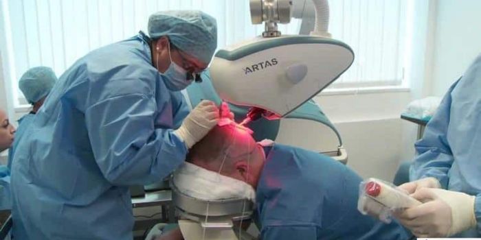 Artas Hair Transplant: Innovative Technology for Hair Restoration